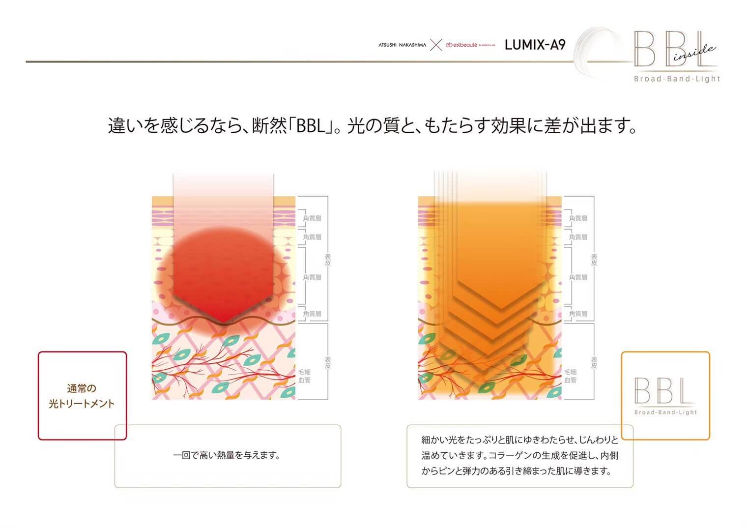 脱毛専門サロンmiumiu （ミュウミュウ）茨城県龍ヶ崎・牛久 脱毛 ルミクスシリーズ 使用機器ーLUMIX-A9